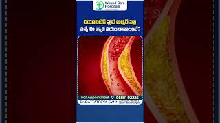 డయాబెటిస్ సమస్యలు  Best Treatment for Diabetic Foot Ulcers  ytshorts diabetes footulcer [upl. by Akemaj]