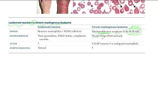 42 Leukemoid reaction vs chronic myelogenous leukemia [upl. by Keen955]