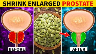 8 Best Foods to Shrink an Enlarged Prostate [upl. by Eelanaj]