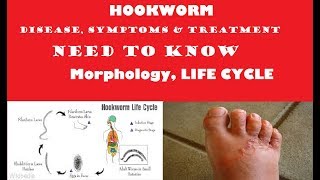 Hookworm  Ancylostoma duodenale  Morphology structure  INFECTION and TREATMENT [upl. by Allare513]