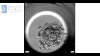 PreImplantation Embryo from Fertilization [upl. by Ardnasxela]