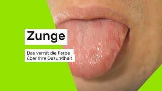 Das verrät die Zungenfarbe über Ihre Gesundheit [upl. by Dilahk]