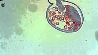 Trichuris trichiura cross section [upl. by Ahsiral106]