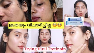 എന്നാലും നീ ആള് കൊള്ളാമല്ലോ 😳 1 Month Experience 😑Trying Viral Tretin cream 🧐 Clear Skin Rs 300 [upl. by Vharat]