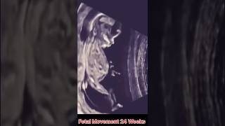 Fetal Movement 24 Weeks [upl. by Aihsemak]