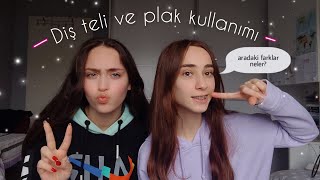 DİŞ TELİ VE PLAK KULLANIMI🦷aradaki farkları anlattık fiyat farklarıtedavi nasıl ilerlerRana ışıl [upl. by Elamaj]