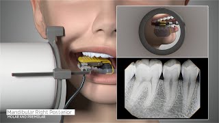 DEXIS™ Titanium by KaVo  Full Mouth Series Positioning Guide [upl. by Asit472]