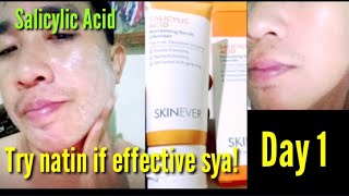 Day 1 Salicylic Acid effective ba [upl. by Doxia]