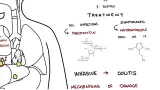 Amebiasis  entamoeba histolytica symptoms pathophysiology diagnosis treatment [upl. by Harvey210]