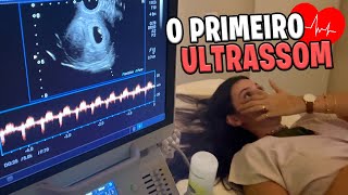 Primeiro ultrassom do Bebê Landim Ouvimos o coraçãozinho e choramos muito [upl. by Norad]