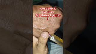 Amoxicillin amp potassium Calvuanate injection ipshrort trending medicalprocedure drxsachin12 [upl. by Ariaet938]