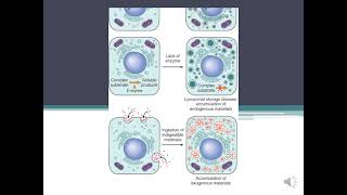 Parenchymal Stromal  Vascular Dystrophiesamp Mixed DystophiesCalcification pathology [upl. by Mountford3]