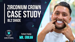 Zirconia Crown Case Study BL2 Shade  Narrated by Dr Omer Karaaslan [upl. by Manfred]