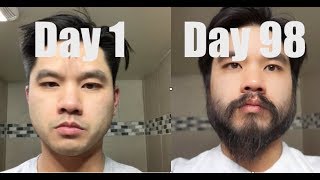 I Grew Out My Beard For 3 Months Using Minoxidil Rogaine [upl. by Nivonod]