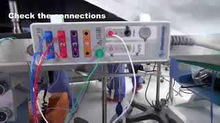 How to setup the intraoperative neuromonitoring [upl. by Aioj]