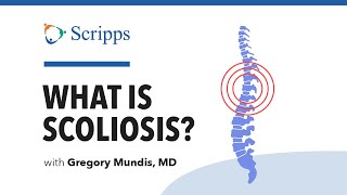 Scoliosis Symptoms and Treatment with Dr Gregory Mundis  San Diego Health [upl. by Ynttirb]