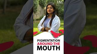 Pigmentation Around the Mouth  Home Remedies [upl. by Tallula903]