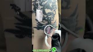 TwoStep Tattoo Removal CO2 Laser amp PicoSecond Laser Explained [upl. by Nylia]