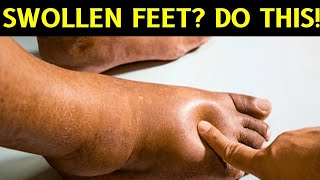 Home Remedies To Cure Swollen Feet and Ankle FAST [upl. by Salta]