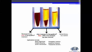 Biotech Support Group HemogloBind™ Hemoglobin Depletion From Hemolyzed SerumPlasma [upl. by Si13]