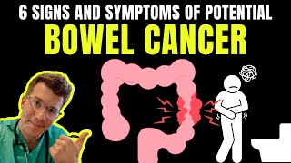 6 SIGNS AND SYMPTOMS OF BOWEL CANCER [upl. by Gies]