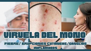 VIRUELA DEL MONO 🐵 Erupciones cutáneas fiebre ganglios ALERTA EPIDEMIOLÓGICA 📢 [upl. by Auqkinahs619]