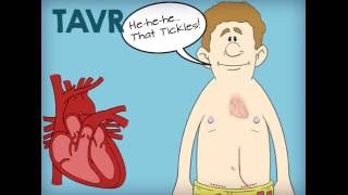 Understanding Aortic Stenosis for Everyone [upl. by Newnorb248]