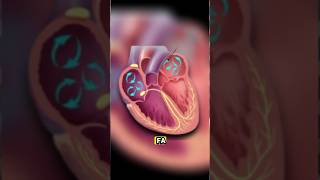 Otras causas de Choque Cardiogénico 🫀 emergency uci [upl. by Hoffarth48]