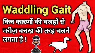 waddling gait explained in hindi  duck like walk  abnormal gait pattern [upl. by Rosenblast456]