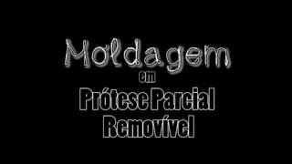 PPR Moldagem Anatômica para Modelo de Trabalho [upl. by Kerwin]