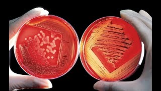 🦠Po jakim czasie probiotyk który ma 2 mld bakterii w kapsułce odbuduje florę jelitową❓ Obliczyłem❗ [upl. by Yahsan]