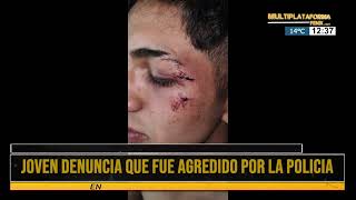 Joven denuncia que fue agredido por la policia [upl. by Dwaine848]