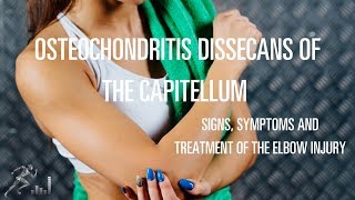 Osteochondritis dissecans OCD of the capitellum Signs symptoms and treatment options [upl. by Nochur]