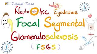 Focal Segmental Glomerulosclerosis FSGS  Nephrotic Syndrome  5MinuteReview [upl. by Quintina899]