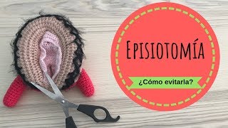 La EPISIOTOMIA ✂️ ¿cómo puedo evitarla [upl. by Neelyt]