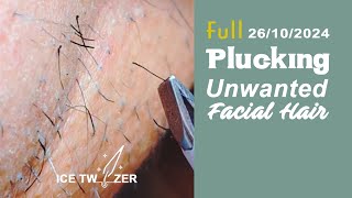 Beard Plucking with Tweezers  PCOS Female Facial Hair Removal [upl. by Eikcim]