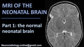 MRI of the Neonatal Brain part 1 the normal neonatal brain [upl. by Norry]