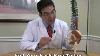 What You Should Know About Sciatica Symptoms and Treatment [upl. by Atinihc]