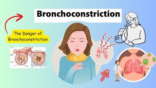 Bronchoconstriction Care and Management [upl. by Audly]