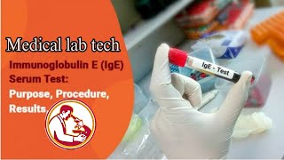 How to perform Total Ige test in ichroma ll [upl. by Nathanson663]