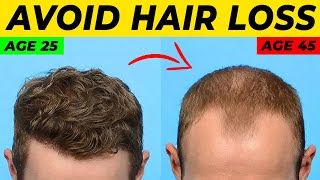 Topical Finasteride For Hair Loss What YOU Need To Know [upl. by Suedama748]