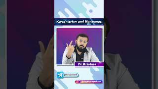 Kwashiorkor Vs Marasmus  Quick Bites [upl. by Phil]