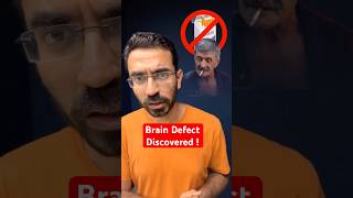 Big Brain Defect Affecting our Lives [upl. by Rolfston]