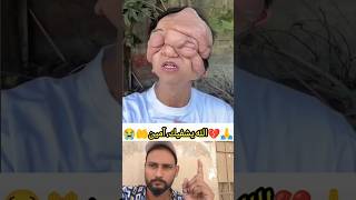 الله يشفيك، آمين🤲💔😭🙏 islamicchanl viral shorts [upl. by Eelirak294]