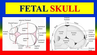 FETAL SKULL  Bones Regions Landmarks amp sutures fontanelles diameters amp Moulding  OBG [upl. by Bohlen78]