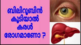 Does high bilirubin always mean liver disease Malayalam [upl. by Cirad]