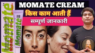 momate cream for skin  momate cream  momate cream uses in hindi  momate cream review [upl. by Hoover]