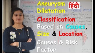 Aneurysm Dilatation in Hindi  Classification Based on Cause Size amp Location  Causes amp Risk Factor [upl. by Arhna]