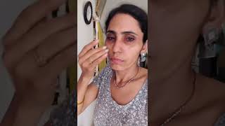 dekho awesome result  How can I remove blackheads at home fast  ghamu saran shorts skincare [upl. by Lekim]