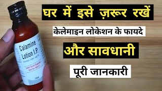 calamine lotion benefits  how to use calamine lotion  uses in hindi [upl. by Zoe740]